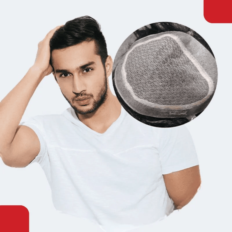 celebrity choice mirage hair system