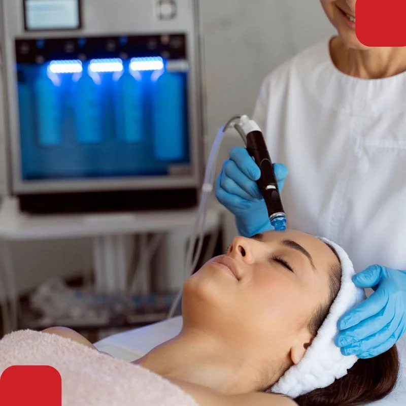 microneedling radiofrequency 1