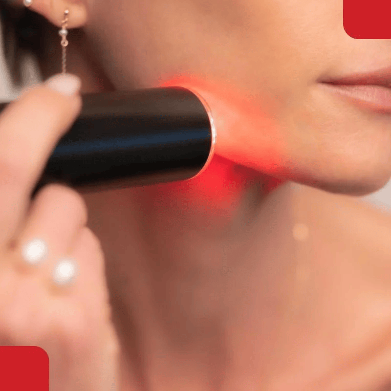 q switched laser therapy